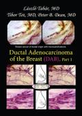 Ductal Adenocarcinoma of the Breast - Part I