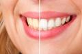 Cosmetic Dentistry - example