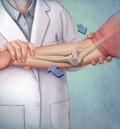 Elbow Procedure