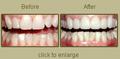 Cosmetic Dentistry Before and After Pictures from Our North Carolina Center