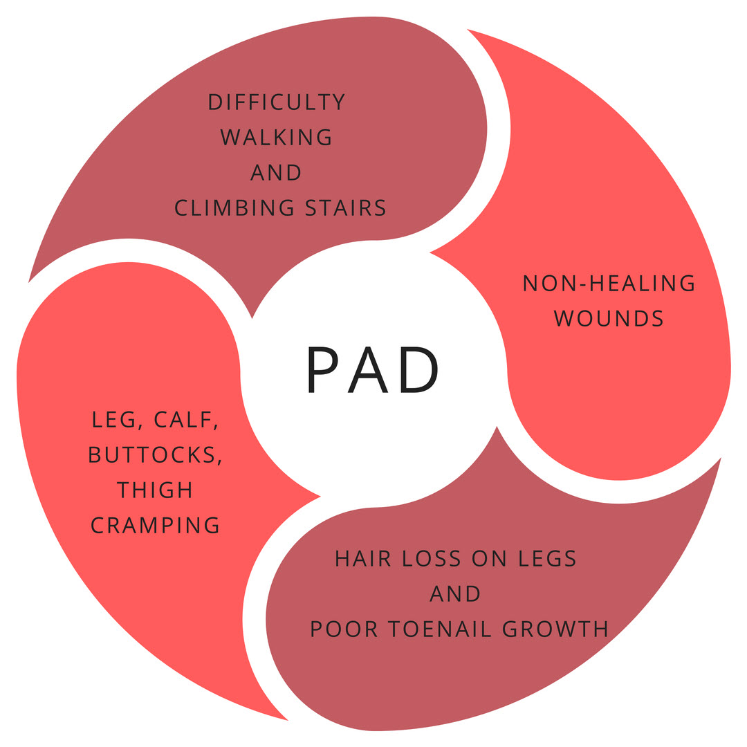 PAD Symptoms