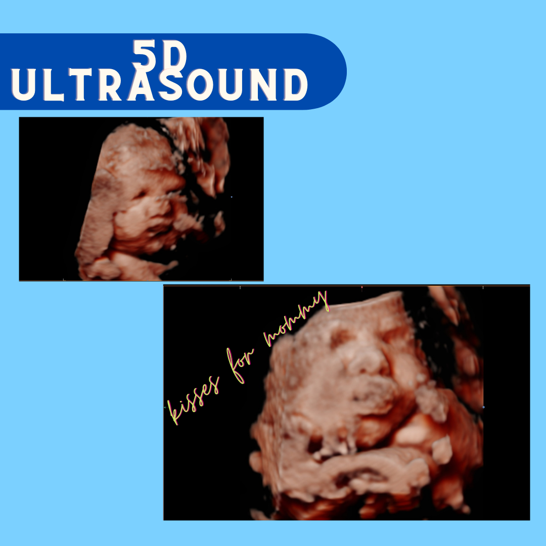 5D Ultrasound