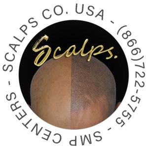 SCALPS | Scalp Micropigmentation Centers's Logo