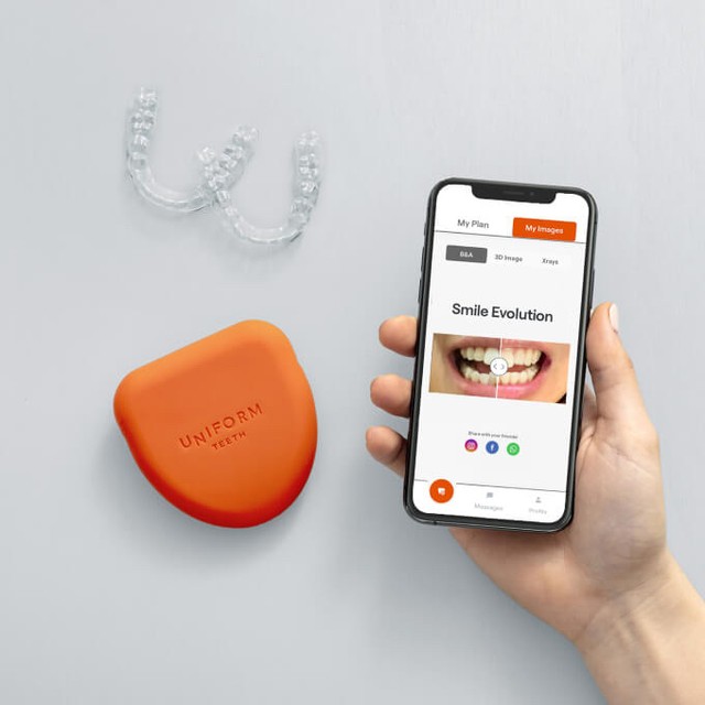 Your orthodontic treatment at Uniform Teeth requires only 3-5 in-person visits. Use the Uniform Teeth app on your smartphone to track your progress