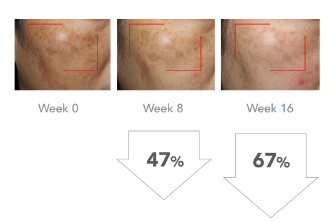 Before And After Results - Cyspera