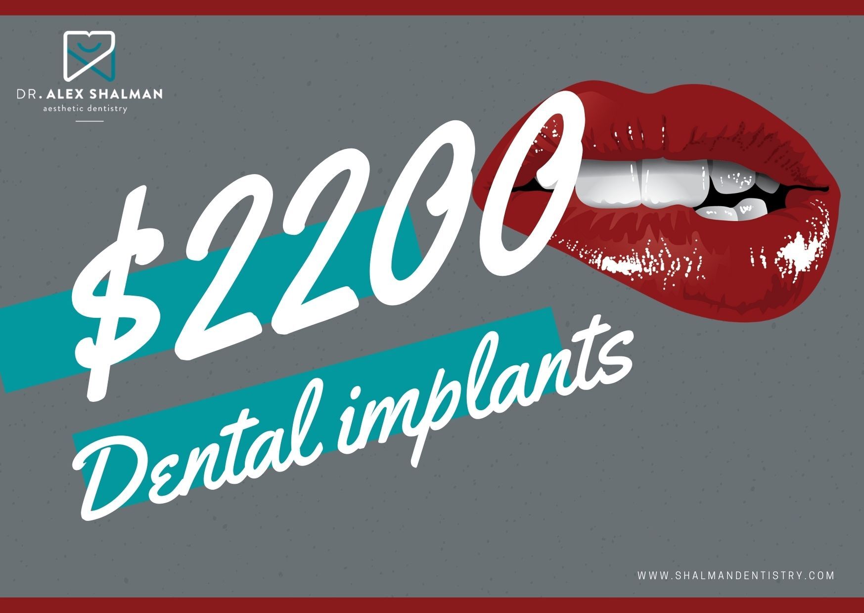 $2200 Dental implants