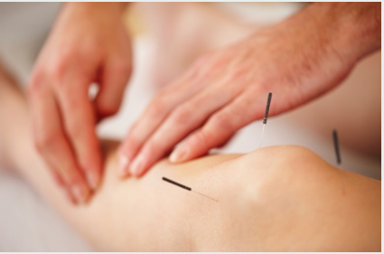 Acupuncture for Knee pain